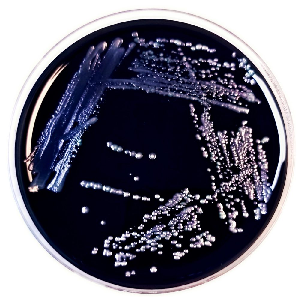 CDC ELITE laboratory expert resource for Legionella testing