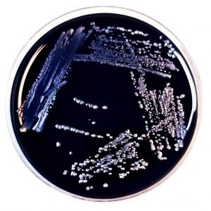 CDC ELITE laboratory expert resource for Legionella testing